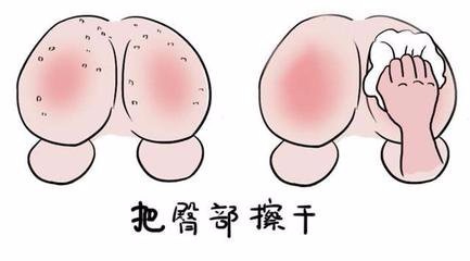 小儿腹泻的一般处理办法
