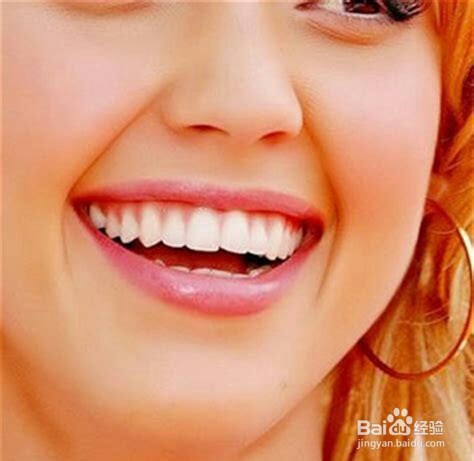 经常洗牙好不好