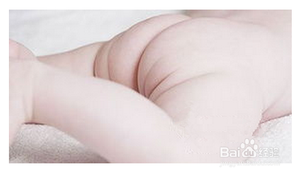 新生儿护理不可忽略的几个问题