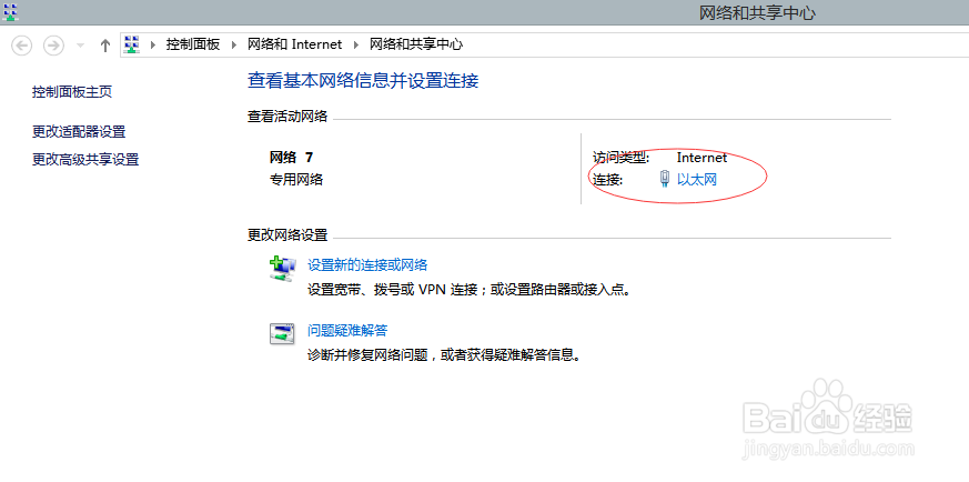 当网络不支持自动识别ip时，如何连接网络？