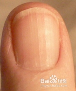 如何判断肝脏是否有毒呢？