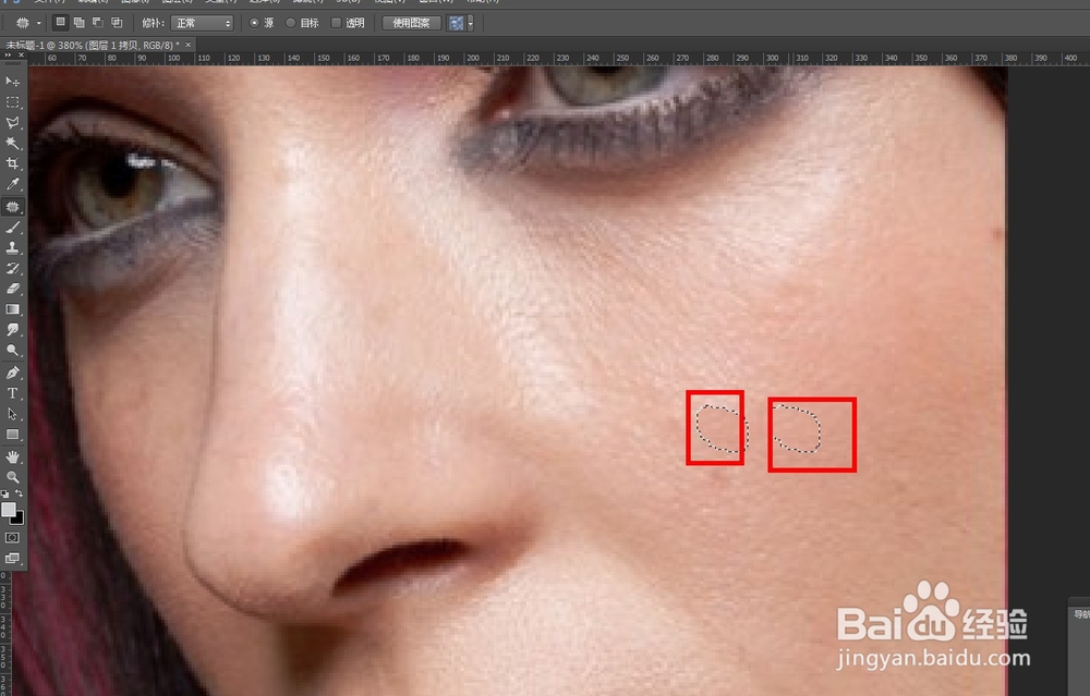 用ps污点修复画笔工具去掉脸上的痘痘