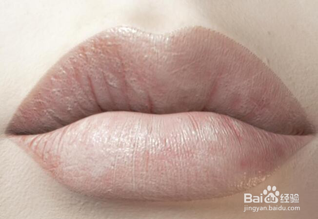 擦口红嘴唇起皮怎么办