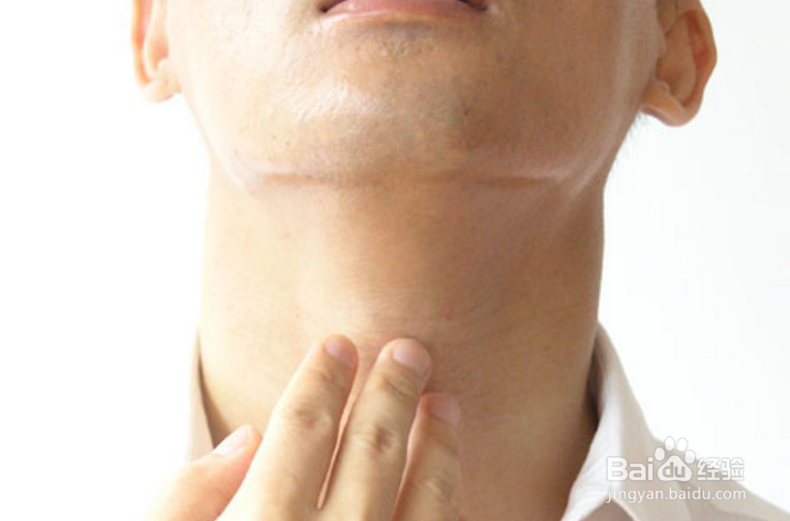 做胃镜的需要注意什么,胃镜检查小知识