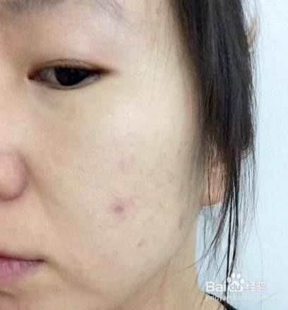 皮肤透露6大健康问题你知道吗?