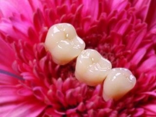 保护牙齿的日常做法是什么?