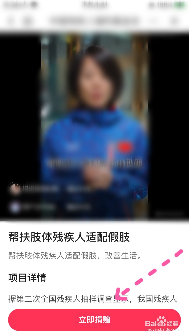 头条如何为假肢公益项目捐赠