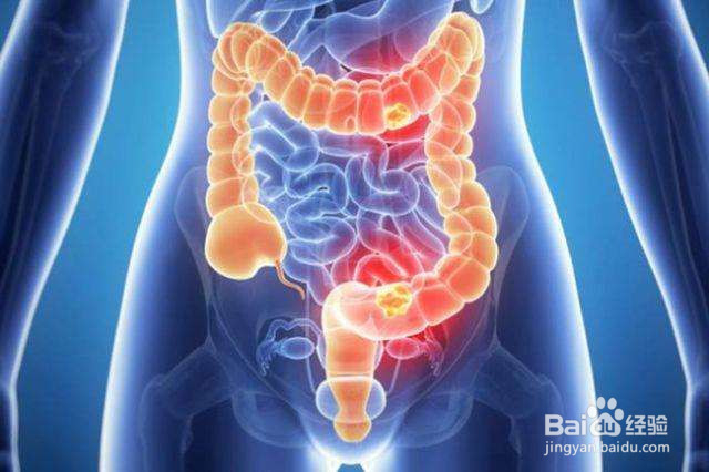 腹泻怎么办、一般是由什么原因引起