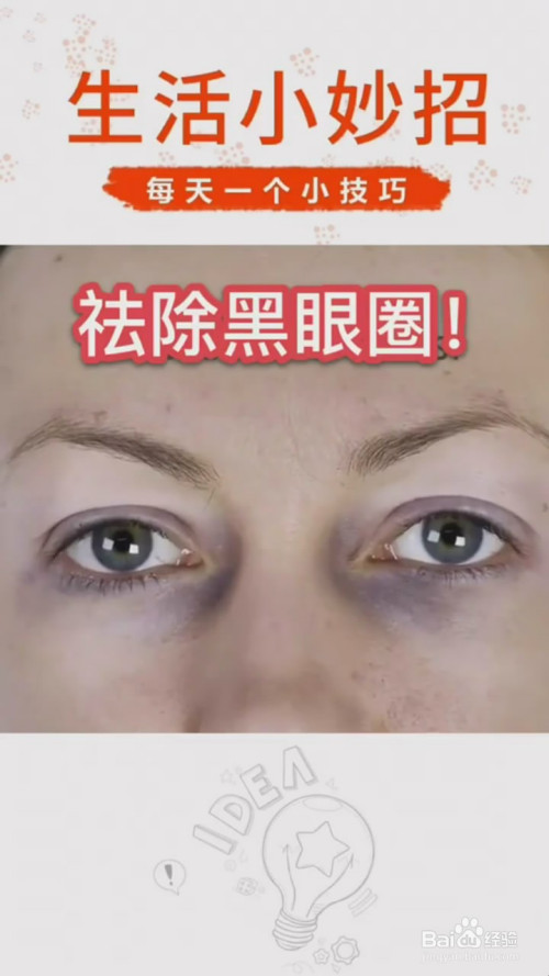 如何去除黑眼圈