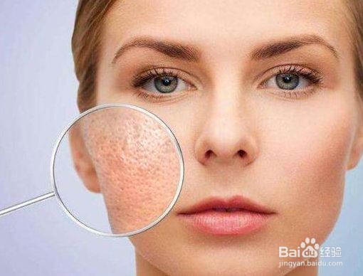 毛孔粗大怎么办？