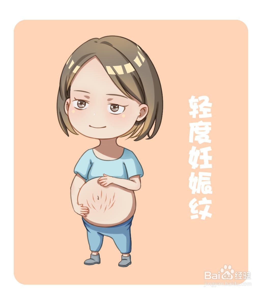 如何治疗妊娠纹