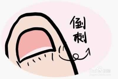 怎么看指甲异常判断宝宝健康状况，以及解决办法