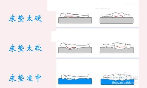如何预防脊椎病