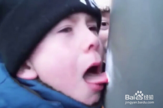 舌头冻在柱子上怎么办