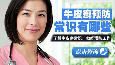牛皮癣要怎么预防好呢