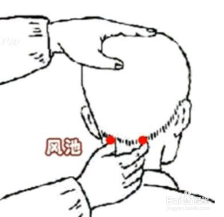 几个穴位搞定落枕!!SO easy!