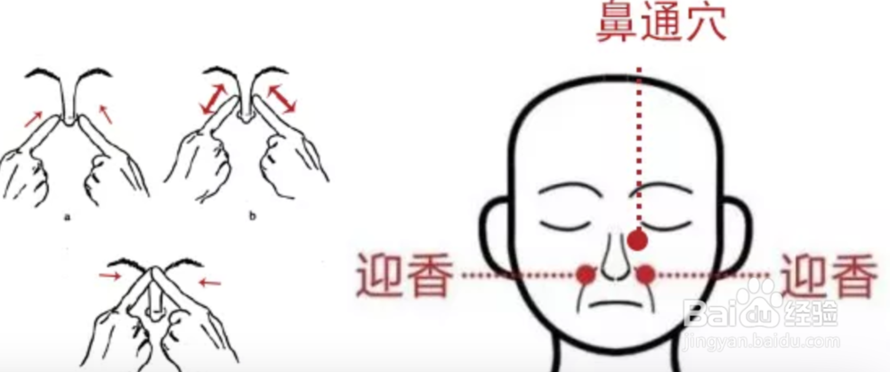 治疗宝宝鼻塞 按这按个穴位最管用！