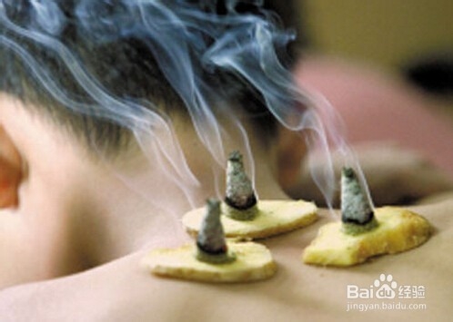 怎样巧妙的治疗一些日常空调病？