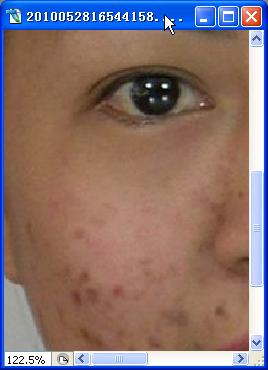 Photoshop CS2.0教你怎样祛痘和让图片亮