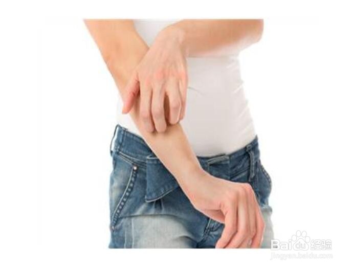 什么情况可以用伊之魅乳膏?