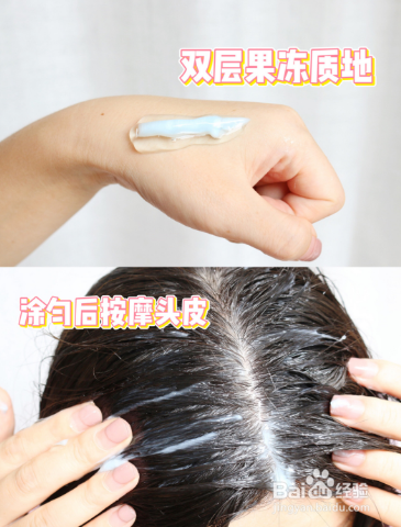 头皮痒用什么洗发水