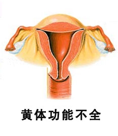 黄体功能不全的治疗方法