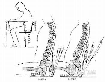 近视眼的日常护理措施