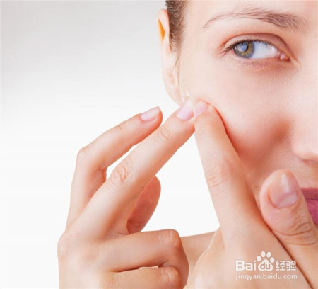 怎样去除痘痘小窍门 史上最强效的祛痘方法