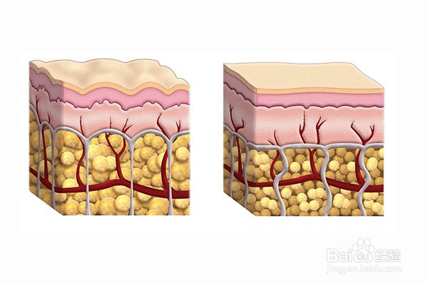 褥疮伤口不同颜色处理方法