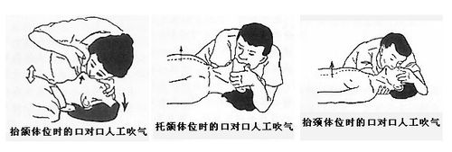 儿童溺水6分钟急救知识