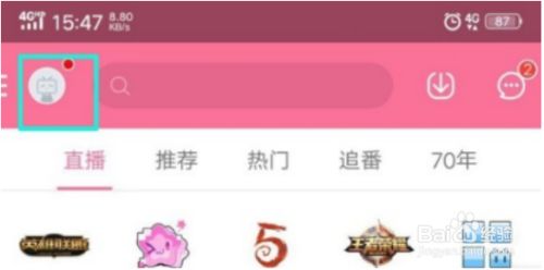 5c2a1ad149299a881359855267eeadbcbf2f7fe1.jpg?x-bce-process=image%2Fresize%2Cm_lfit%2Cw_500%2Climit_1%2Fformat%2Cf_jpg%2Fquality%2Cq_80