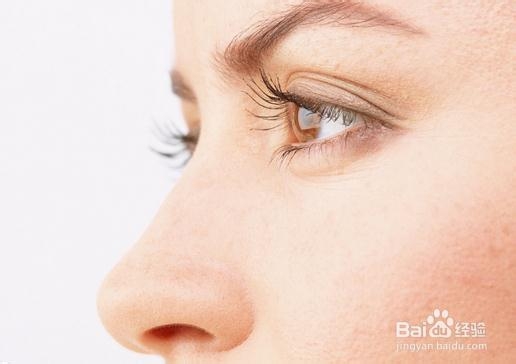 眼屎多是怎么回事