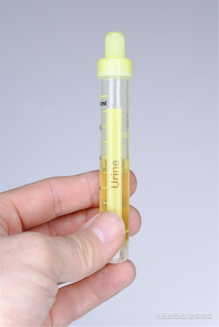 喝完水就想小便的原因