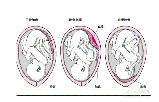 如果坐月子要注意什么,吃什么好