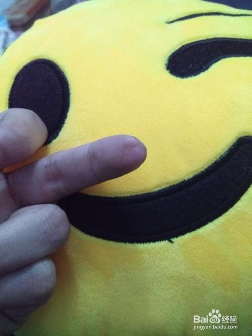 脸上和手上总很多灰尘怎么办