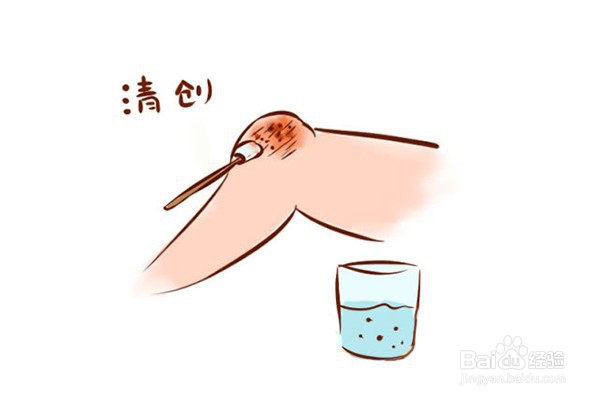 伤口愈合快的方法