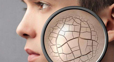 怎样判断脸上有角质