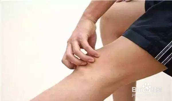 膝关节炎的治疗方法