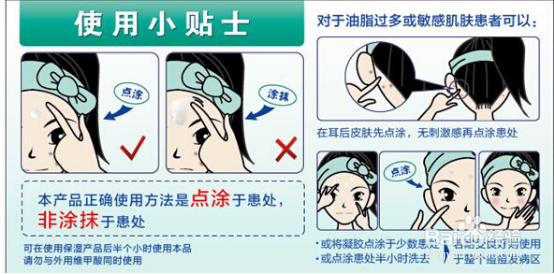 三种降火祛痘效果极佳的传统方法