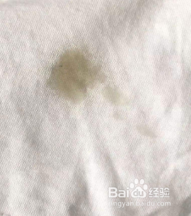 衣服上的油渍怎么去除