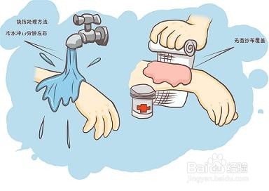处理孩子烫伤方法的误区有哪些？怎么办？