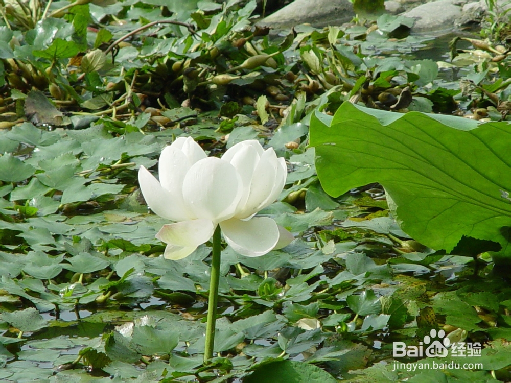 谈谈年轻爸爸妈妈不能忽视刚出生婴儿常见病之四