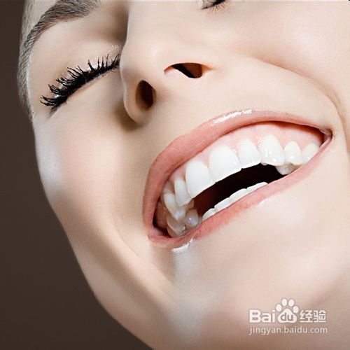 牙齿美白需要注意什么