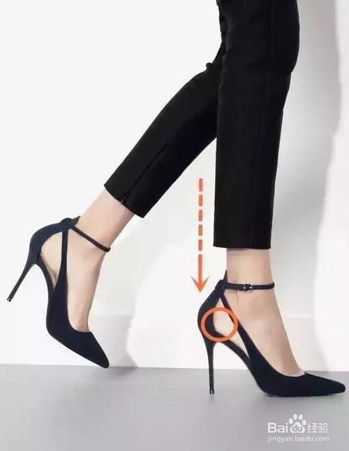 髌骨软化症如何诊断