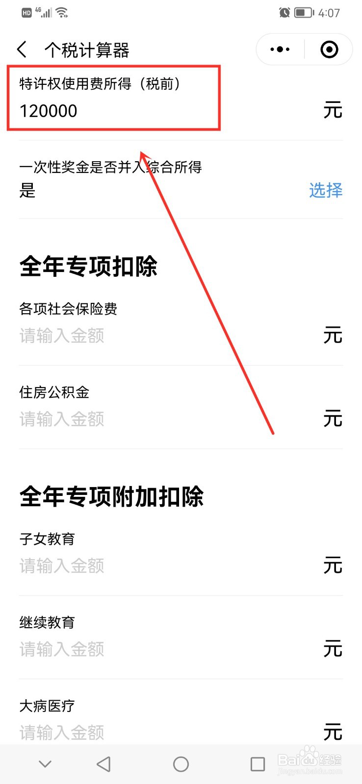 特许权使用费预扣预缴计算方法