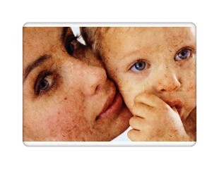 盲目补钙危害多，这些补钙误区你知道吗？