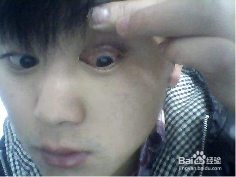 肝不好的人有什么特征