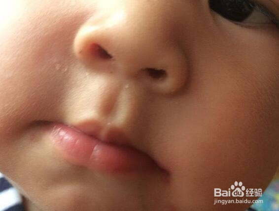擦口红嘴唇起皮怎么办
