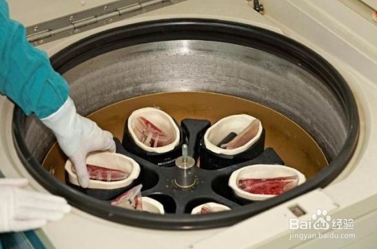 储存自体脐带血的5大优势