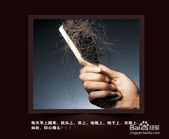 脱发是什么原因及如何治疗